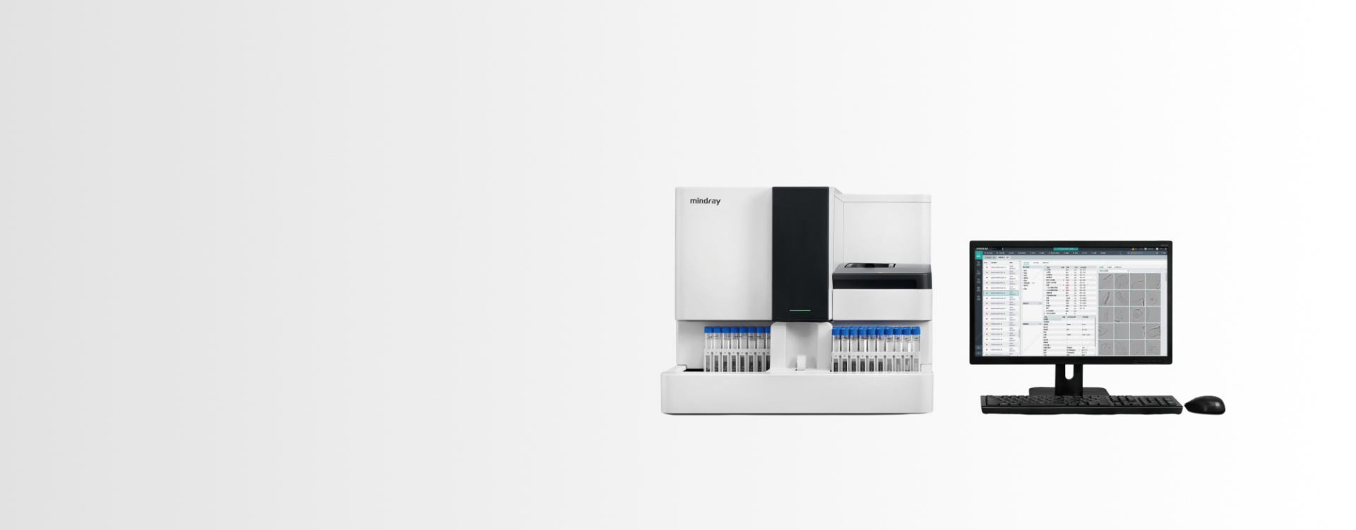 Automated-Urinalysis-System